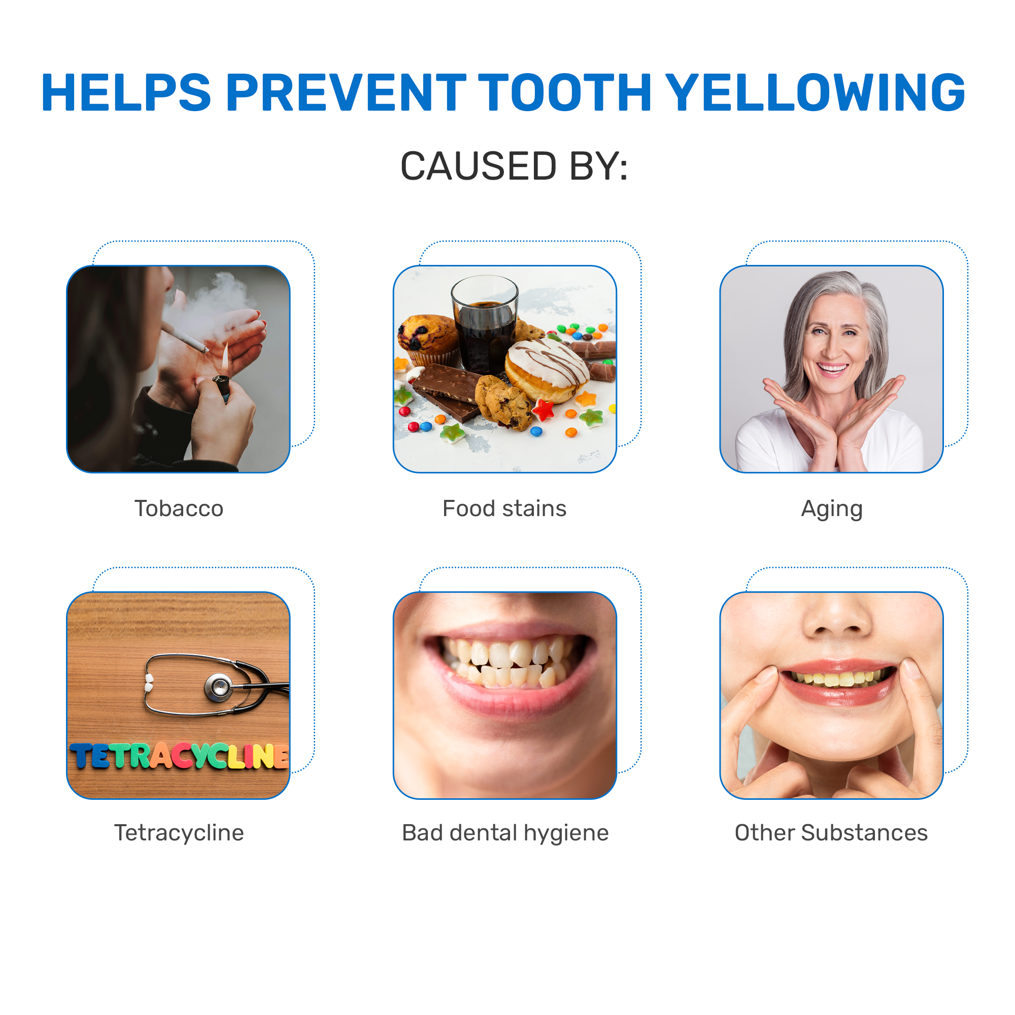 Kit per lo sbiancamento dei denti